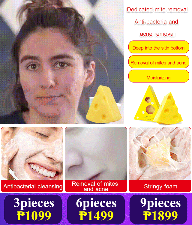 Cheese soap stringy acne and mites removal soap