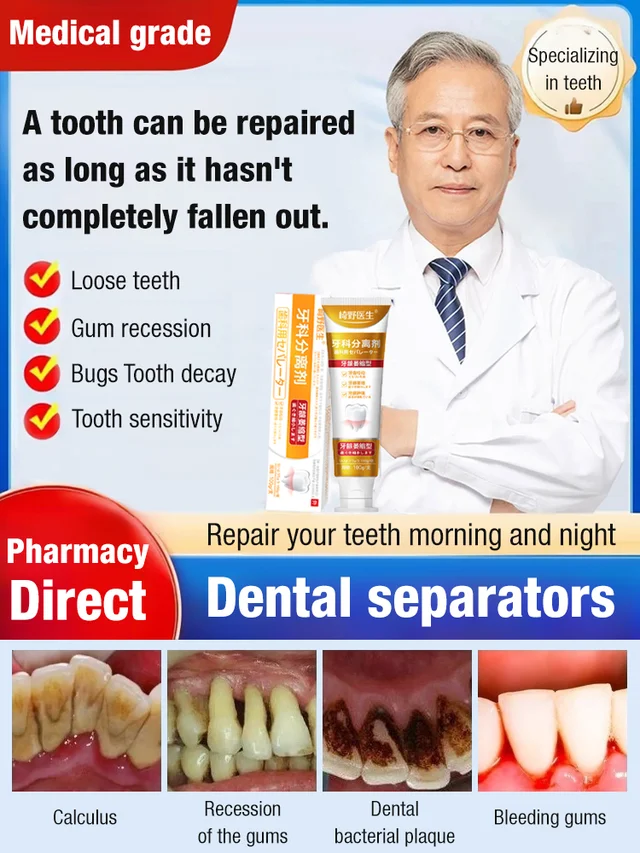 Dental separators