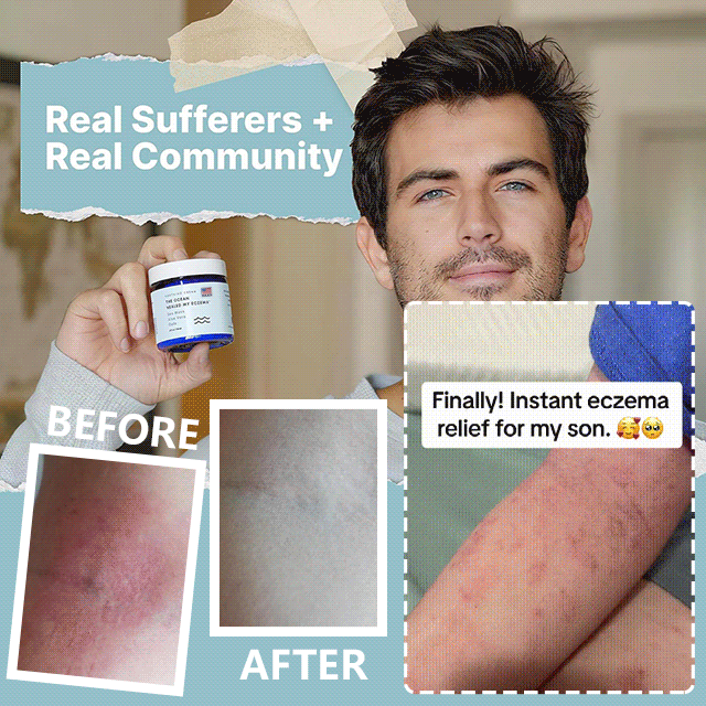 Ocean Natural Eczema Relief Cream