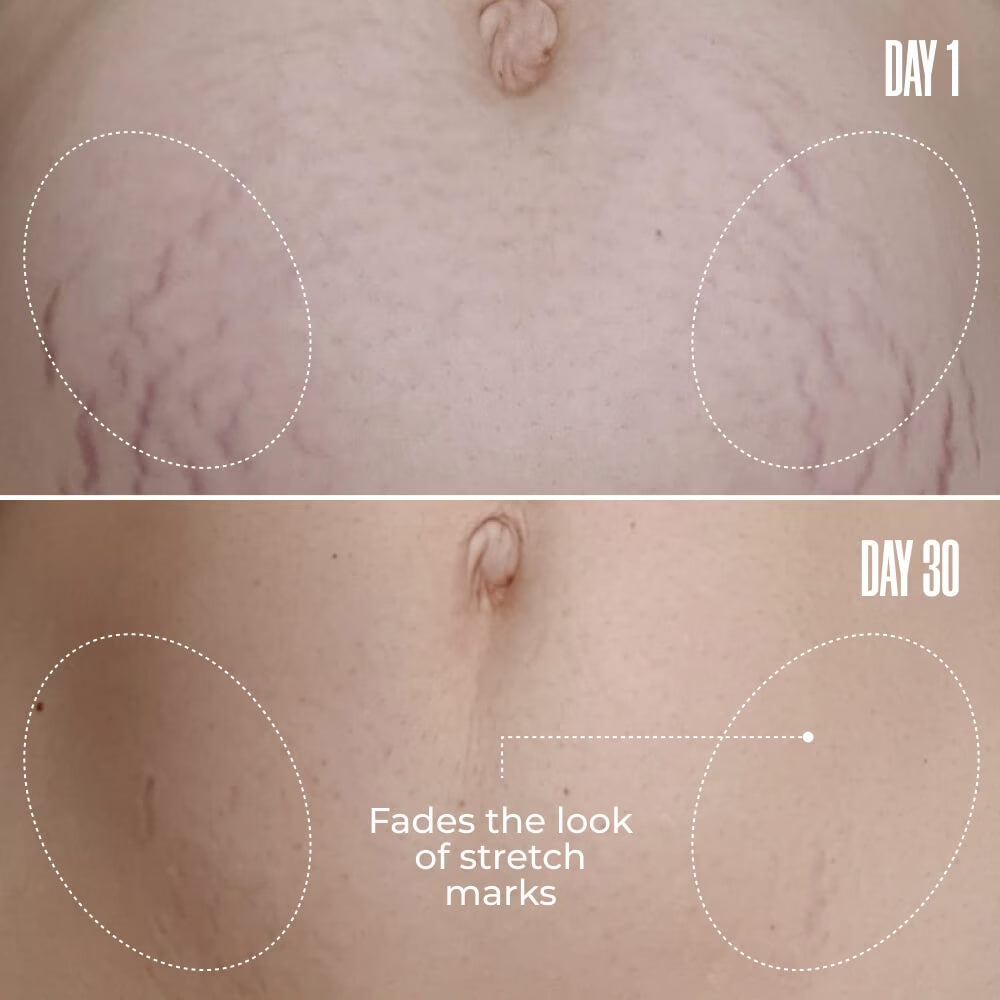 B FLAT Belly Firming Cream