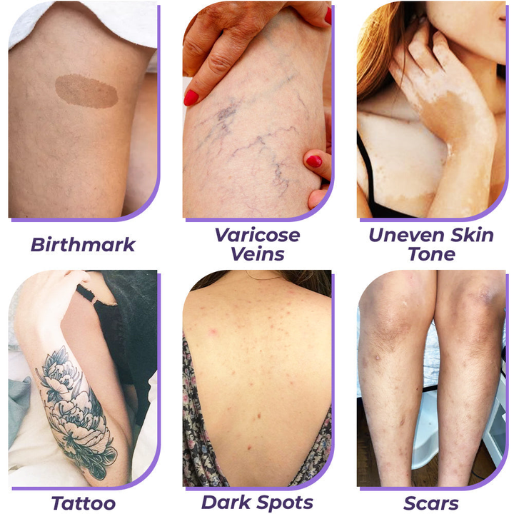 Body Concealer