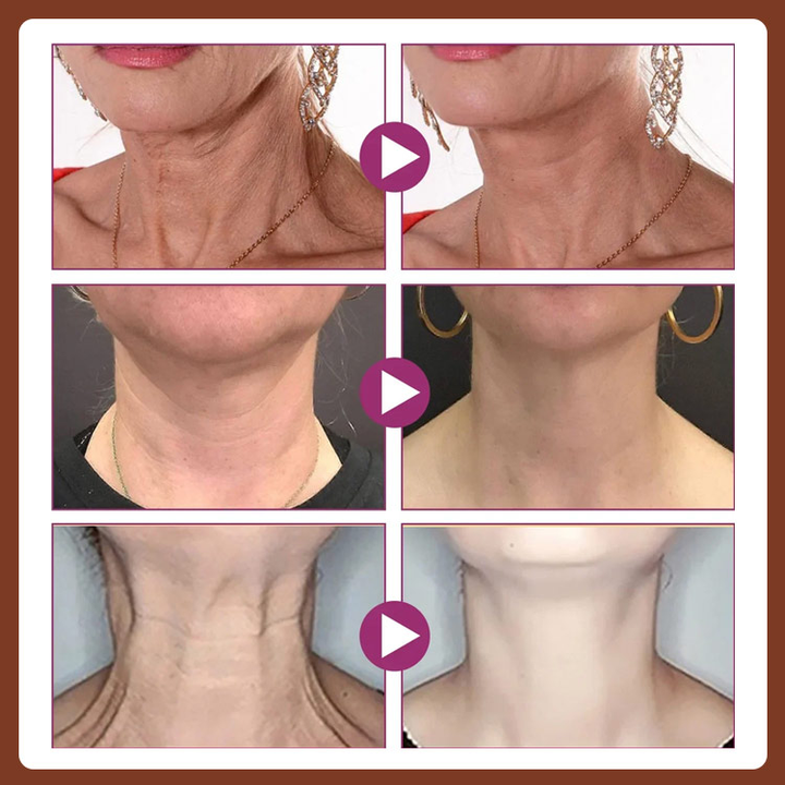 2024 New Year Promotion -Double Retinol Anti-wrinkle Neck Cream - Lighten Neck Lines, Firming Neck Skin, No Double Chin