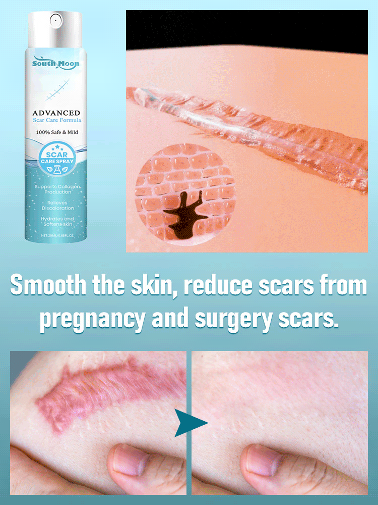 Advanced Scar Removal Spray