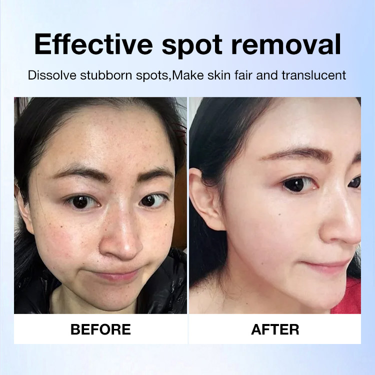 PIBAMY Whitening and spot removing serum