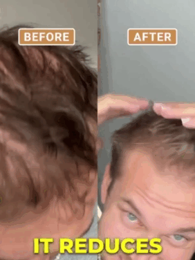 Thickening Anti Fallout Fixing Repairing Shampoo