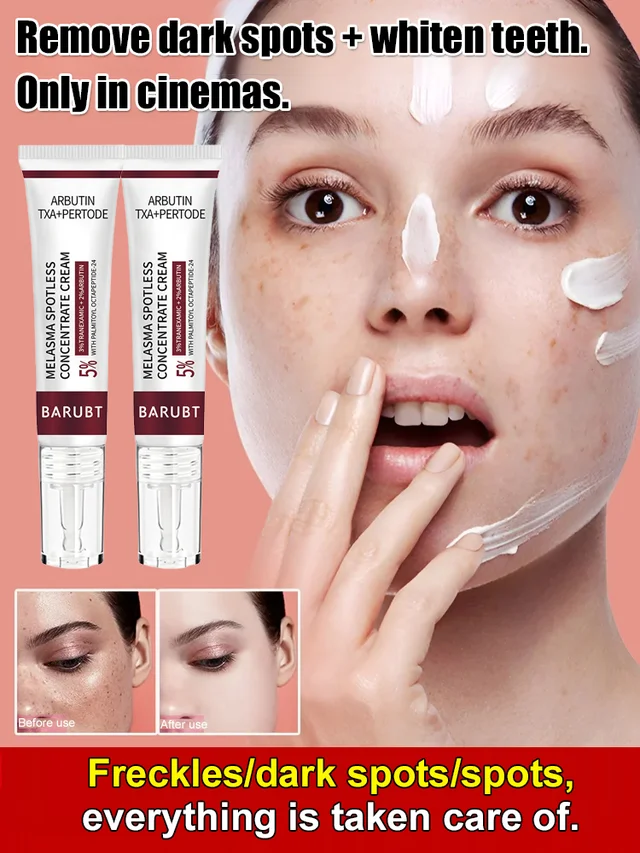 Whitening and spot cream