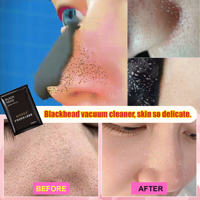 Mineral Mud Blackhead Removal Nose Pore Strips