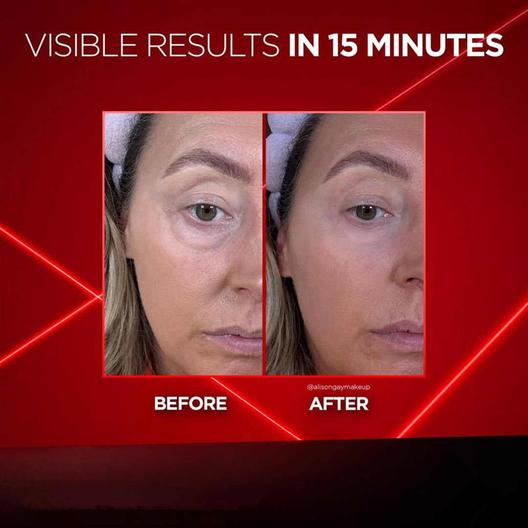 EYE BAG INSTANT ERASER - New Formula, Ultimate Lift & Smooth Finish✨