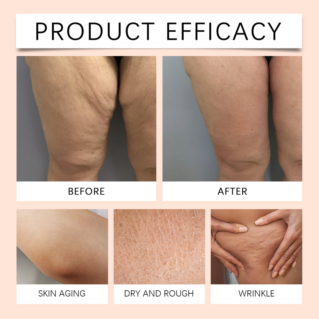 🏆LIMITED TIME OFFER⚡ 50K+ SOLD! ALMOST GONE-💥Advanced Multi-Action Firming Cream