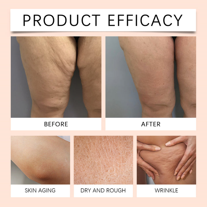 🏆LIMITED TIME OFFER⚡ 50K+ SOLD! ALMOST GONE-💥Advanced Multi-Action Firming Cream