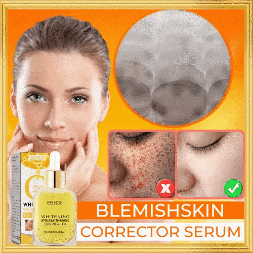 Whitening Skin Melanin Correcting Facial Serum [Experience Flawless Skin, Starting Here!!!]
