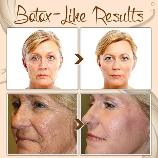 💥Daily Sales of 3000+🔥 2025 Hot Sale Brightening-Instant Eye Temporary Eye Tightener