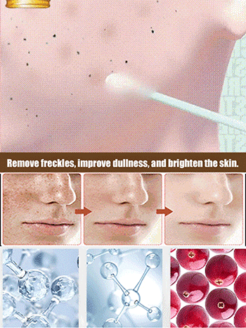 Whitening and spot cream