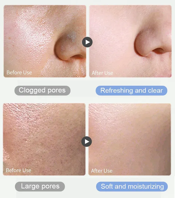 💥Big Discount Today - 2024 New Cleansing mud mask