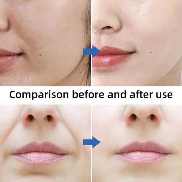 Reduce fine lines remove wrinkles moisturizing firming V face lifting mask