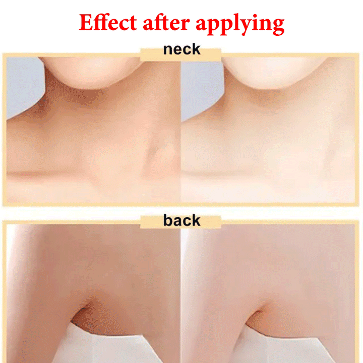 body whitening cream