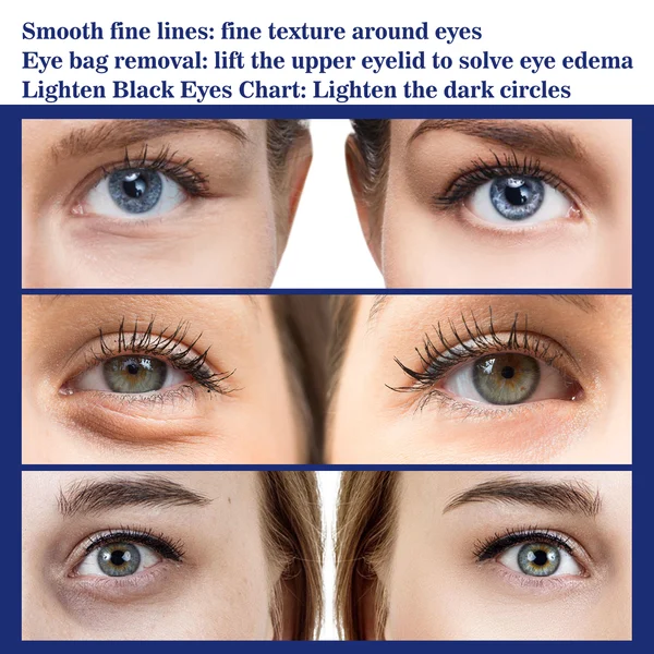 🎁Last Day 49% OFF🎁Instant Eye Lift