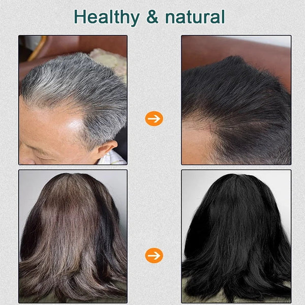 🌿Natural plant hair dye | 🔥High repurchase rate