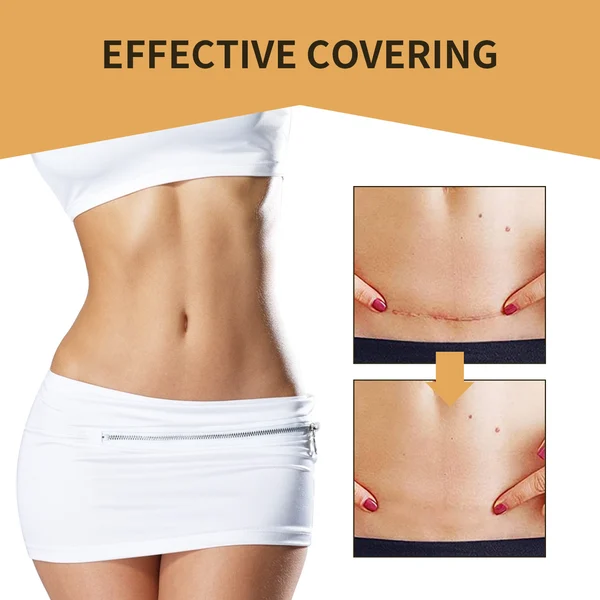 Skin Invisible Concealer Patch