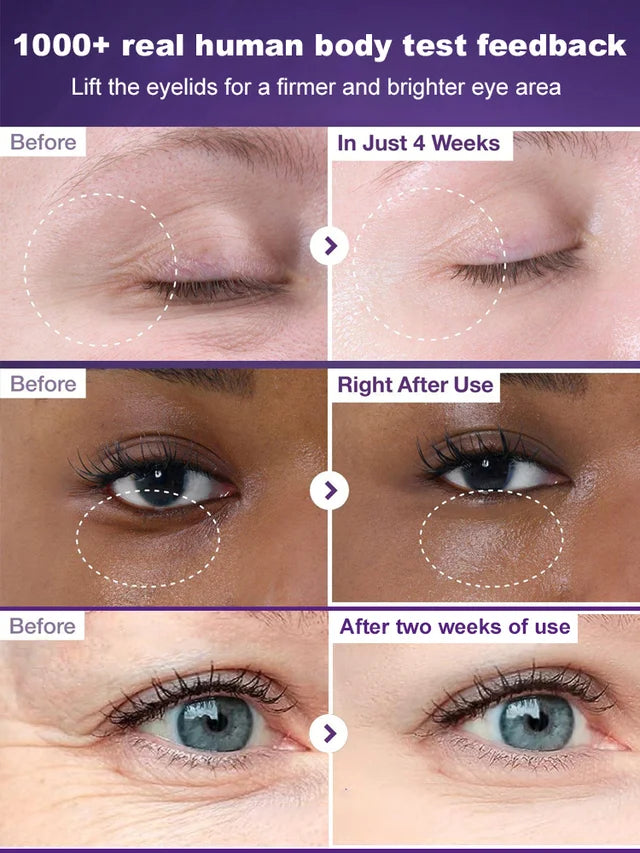 Wrinkle-Retinol Firming Eye Cream🔥BUY 1 GET 1 FREE🔥
