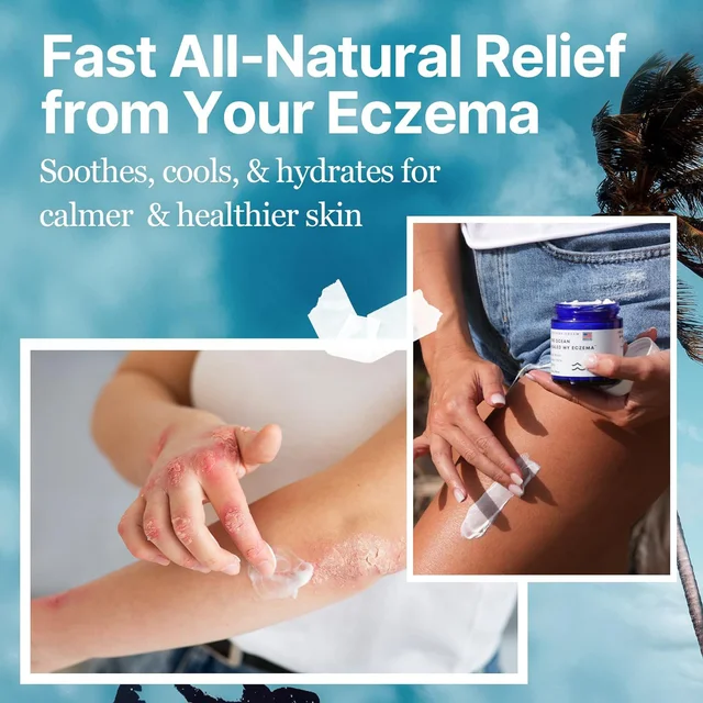 Ocean Natural Eczema Relief Cream