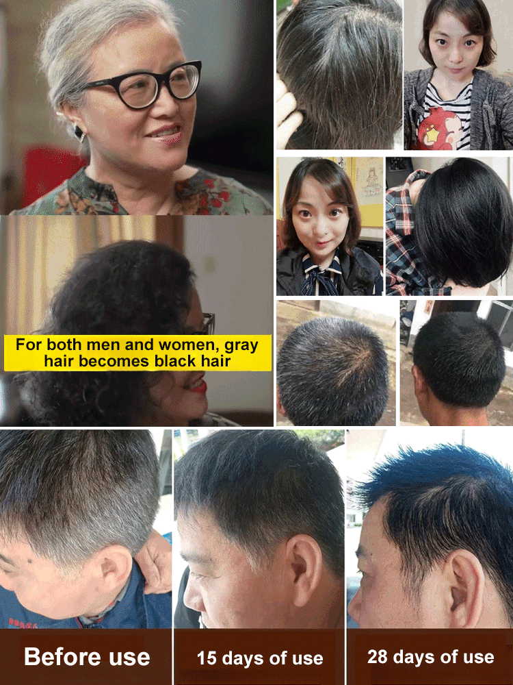 Ginseng Hair Growth Thickening Hair