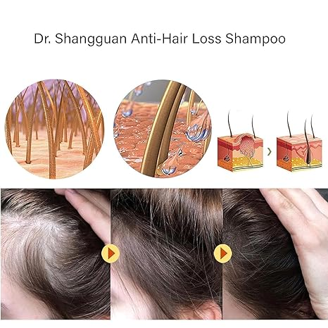 Anti-Hair Loss Shampoo
