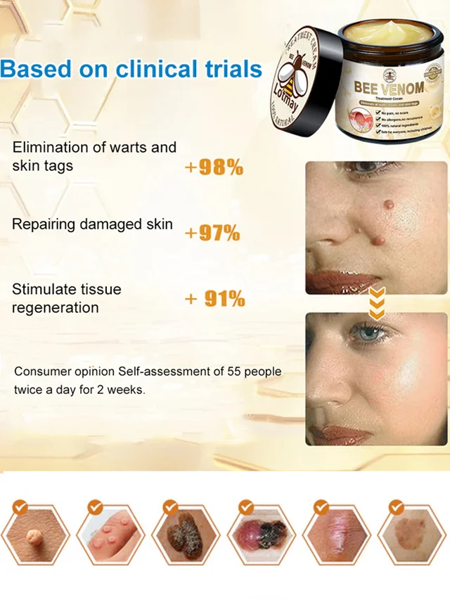 Skin moss nevus and granular skin repair cream