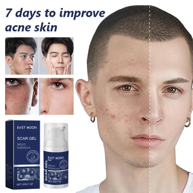 Mens Skin Care Gel