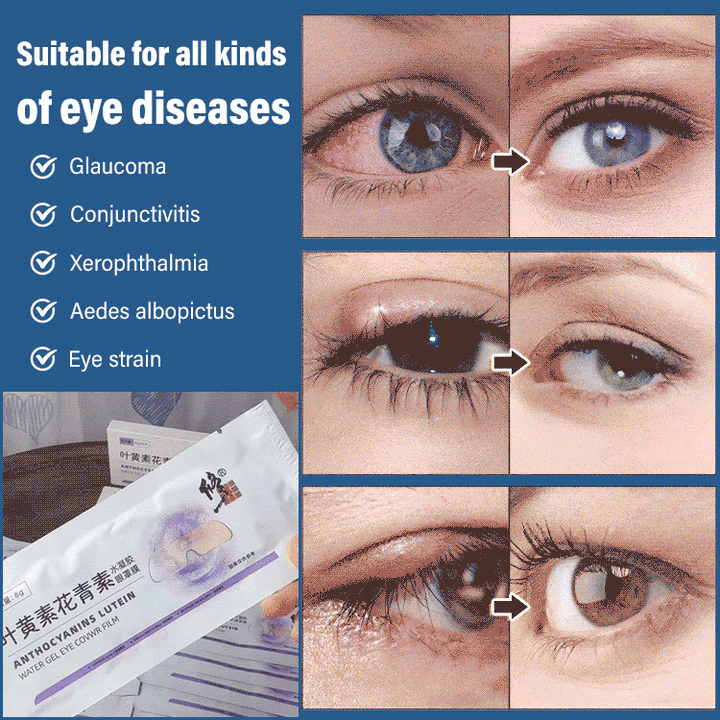 Lutein and Anthocyanin Eye Patches