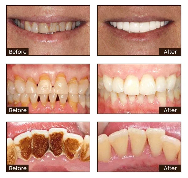XOERMIOY NIACINAMIDE WHITENING TOOTHPASTE