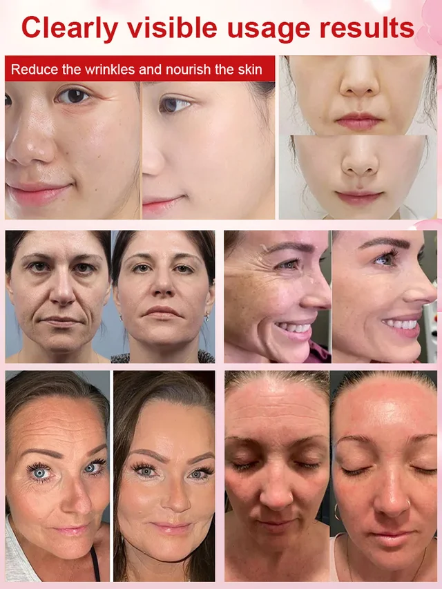 Anti-wrinkle Essence Cream