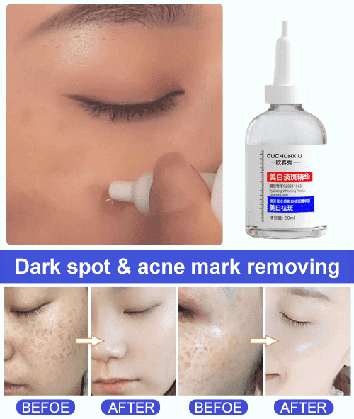 Brightening and Spot Removing Serum
