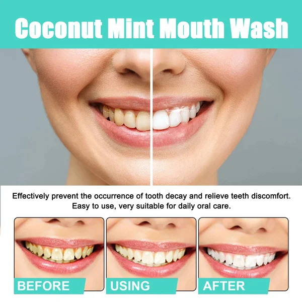 🔥LAST DAY 50% OFF⏰Cocomint Pulling Oil with 7 Essential Oils & Vitamins D E & K2