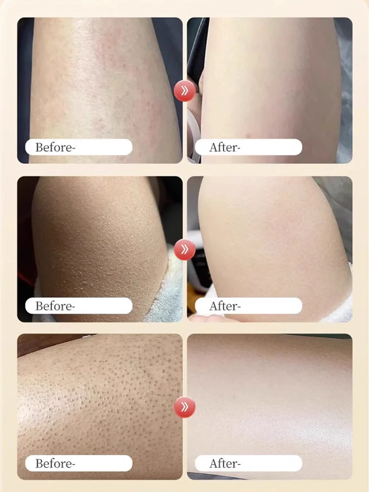 [Specially developed for autumn and winter] Anti itch moisturizing body lotion