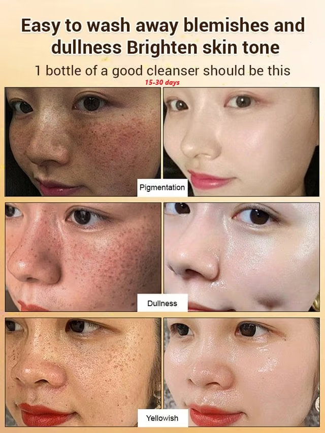 Upgraded anti-freckle essence oil🔥BUY 1 GET 1 FREE🔥
