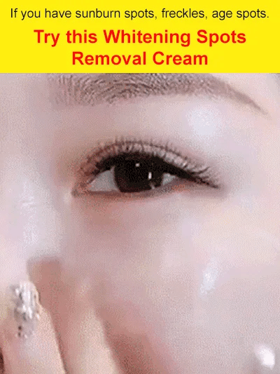 377 Whitening Spots Removal Cream