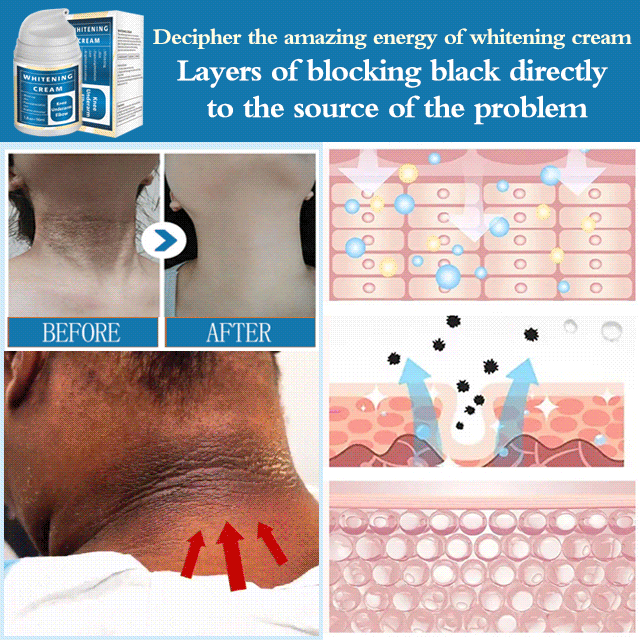 Armpit Melanin Removal Whitening Cream