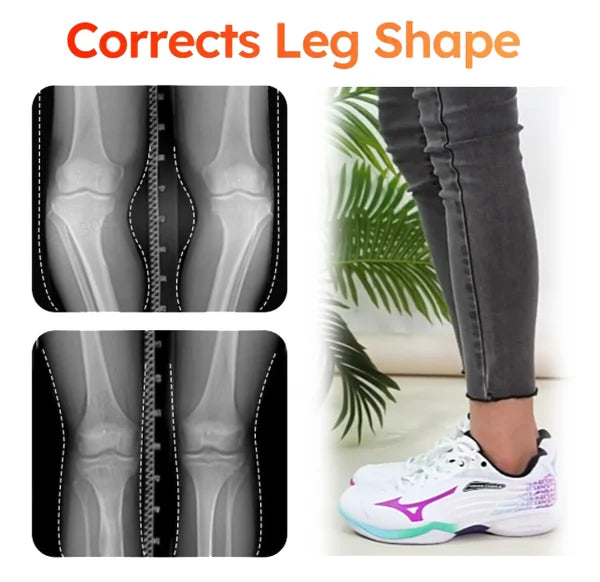 🔥Black Friday Sale 49% Off🔥Revolutionary Orthopedic Insole