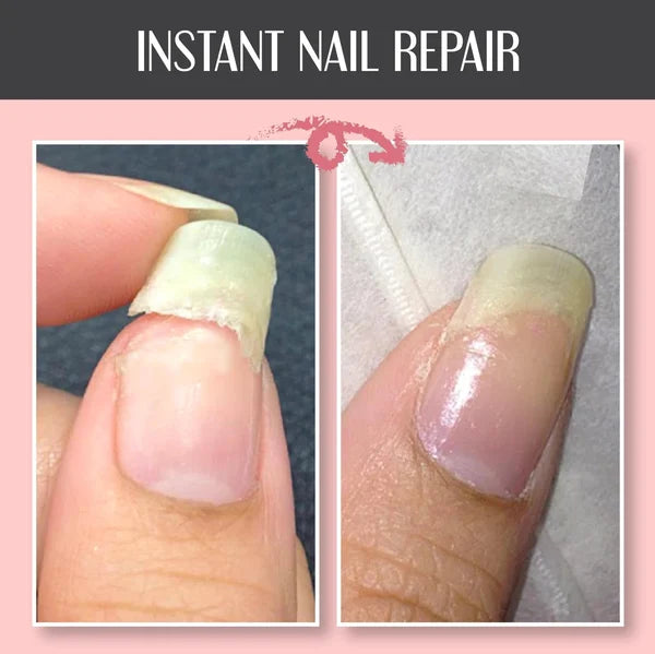🔥Hot Sale-48% OFF-2024 NAIL REPAIR PROTECTION GEL