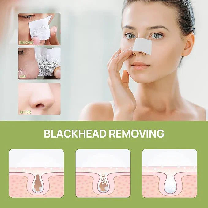 Blackhead Remover Mask: The Ultimate Solution for Clear Skin