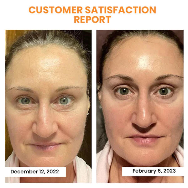 Korean Dermalayr Technology Soluble Collagen Film