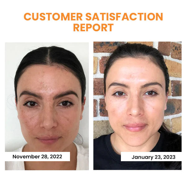 Korean Dermalayr Technology Soluble Collagen Film