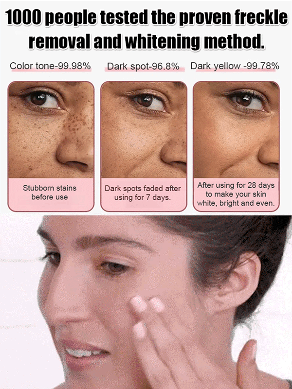Whitening and spot cream
