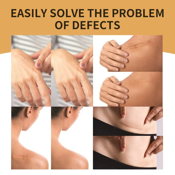Skin Invisible Concealer Patch