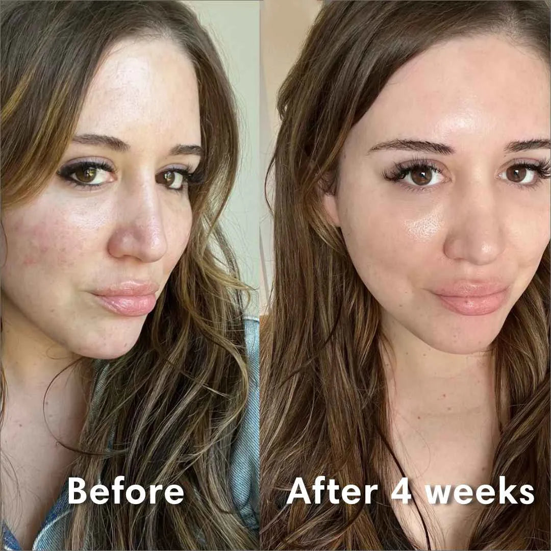 🔥2024 NEW BIO-COLLAGENREAL DEEP MASK