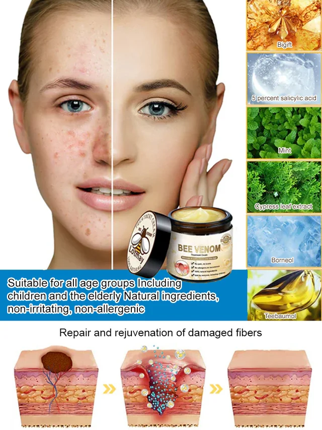 Skin moss nevus and granular skin repair cream