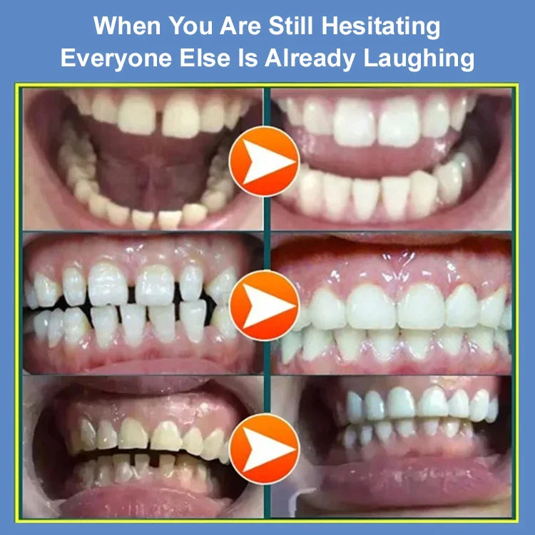 Dental Repair Spray-Buy 1 Get 1 Free