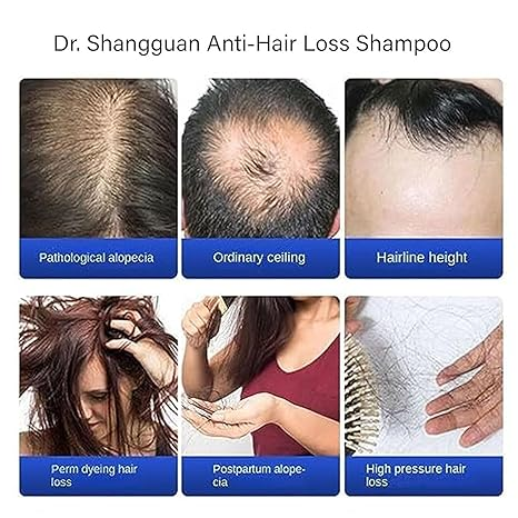 Anti-Hair Loss Shampoo