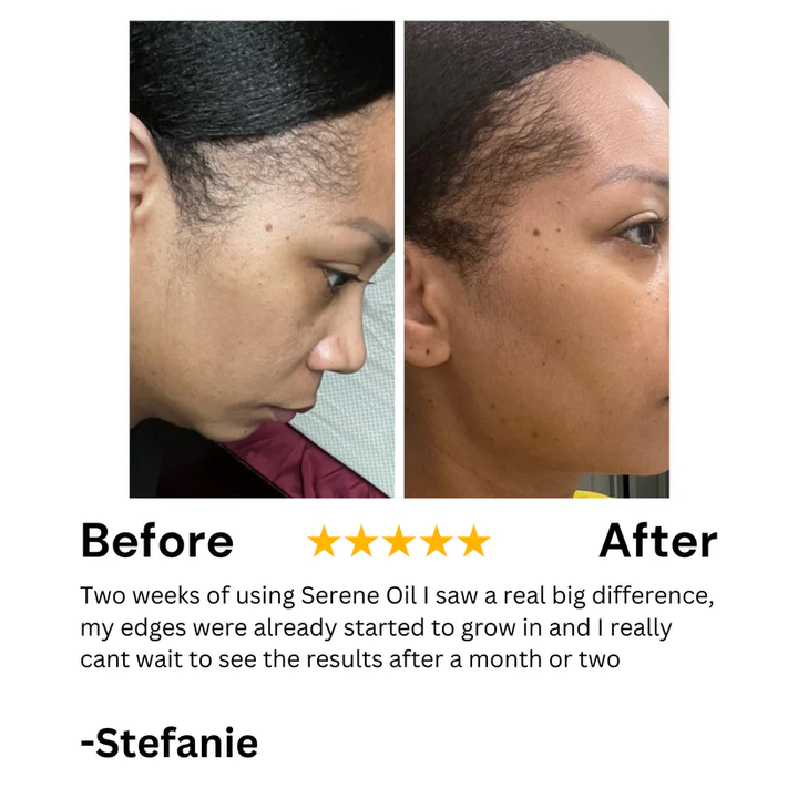 Batana natural Hair Growth Oil